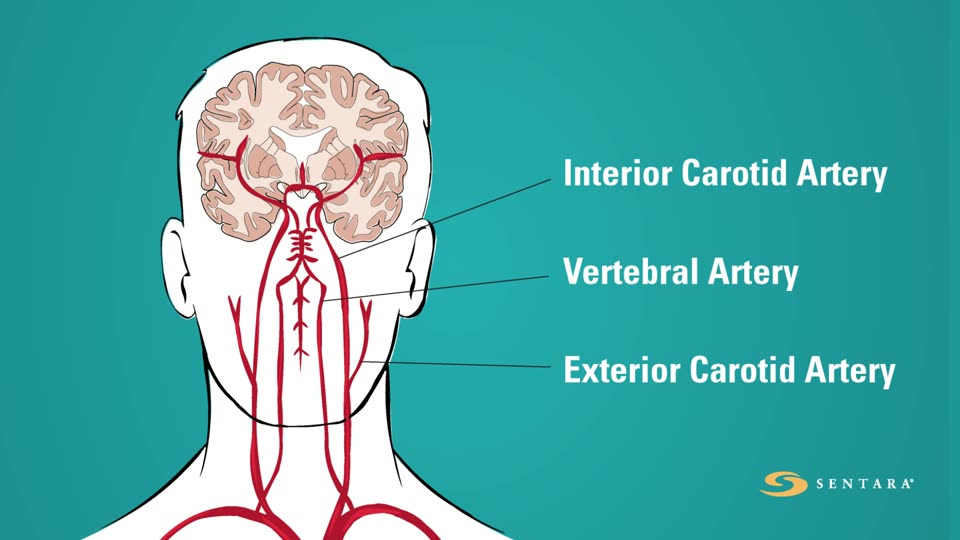 Frame from Blood supply to the brain.